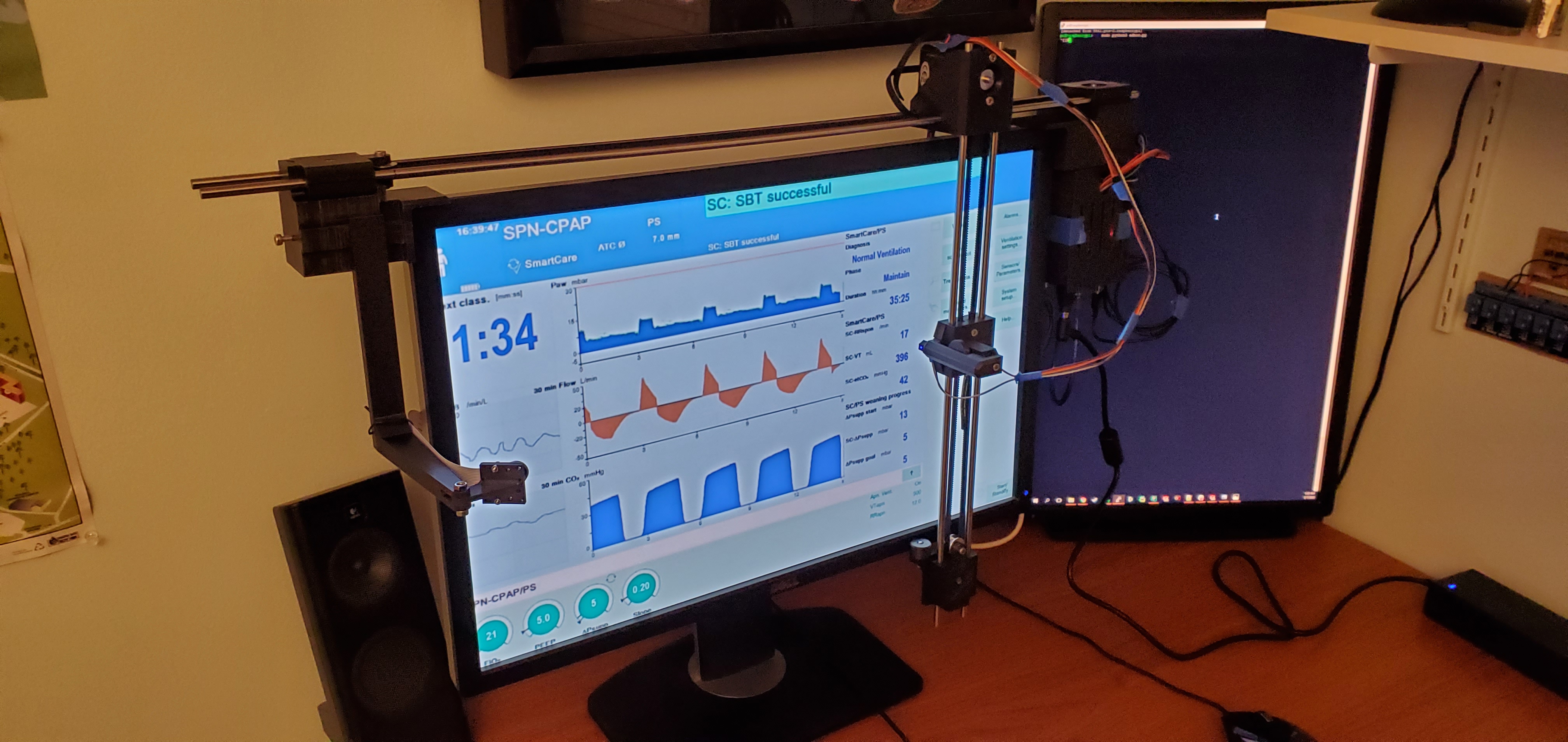 Remote Ventilator Control